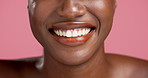 Happy, teeth and mouth of black woman in studio for dental hygiene, wellness or health. Smile, oral care and African female person with tooth whitening, orthodontics or dentistry by pink background
