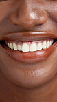 Beauty, mouth and smile of black woman closeup for dental care, oral hygiene or satisfaction. Skin, teeth and whitening with happy African model at dentist for orthodontics results or wellness