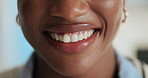 Happy, dentistry and mouth of black woman with hygiene, health and wellness for clean teeth. Smile, oral care and portrait of African female person with tooth whitening, grooming or treatment.