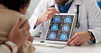 X ray, tablet and doctor with child for consulting, explain diagnosis and neurology treatment. Healthcare, pediatrician and girl with digital brain scan for surgery, medical service and results