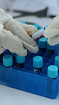 Blood sample, research and hands of person in lab for antibody reaction, protein panel and dna genome. Vaccine analysis, medical study and antigen levels with scientist in clinic for virus pathology