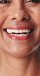 Dental, face and funny with woman closeup for satisfaction of oral care or hygiene results. Mouth, orthodontics and teeth with happy mature person laughing for dentistry benefits or wellness