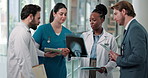 Xray, discussion and team of doctors and nurses in hospital for medical diagnosis in collaboration. Radiography image, tablet and group of healthcare employees with treatment planning in clinic.