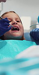 Girl, child and hands with dentist for cleaning teeth, dental surgery or operation in clinic. Kid, teenager or orthodontist checking mouth with oral tools for cavity, tooth bacteria or plaque removal