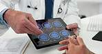 Hands, tablet screen and doctor with brain scan, consultation and feedback with appointment. Closeup, medical service and man in clinic, patient or neuroscience with results, explain or healthcare