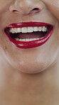 Dental, teeth or smile in closeup for orthodontics, veneer or gum care in mouth wellness. Pride, laugh and female person at dentist with hygiene, whitening treatment or dentistry in oral health.