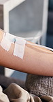 Person, IV drip and arm vein with medical treatment for immune booster, vitamins or nutrition. Closeup, patient or injection with blood infusion or fluid bypass for chronic condition in health clinic