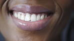 Smile, studio and mouth of woman for dental treatment, oral wellness and teeth whitening results. Healthcare, happy and person with closeup for orthodontics, gum health and hygiene for grooming