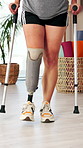Prosthetic legs, crutches or woman in clinic, walking for recovery or healing. Rehabilitation, health or patient in hospital, amputee or practice for physic therapy, support or person with disability