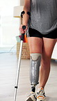 Physiotherapist, amputee and legs with people, walking and rehabilitation for person with disability. Man, woman or consultation for medical prosthetic, physical therapy or crutches for support