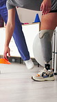 Hands, amputee and person with prosthetic for physiotherapy, fitness and balance training. Physio, walking and patient with disability for limb strength, mobility and cones for gait rehabilitation