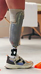 Legs, amputee and person with prosthetic for physiotherapy, fitness and balance training. Closeup, walking and patient with disability for limb strength, mobility and cones for gait rehabilitation