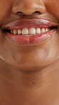 Dental, smile and self care with mouth of woman for gum health, oral hygiene and healthcare. Veneers, teeth whitening and cleaning with closeup of lips of person for orthodontic, wellness and happy