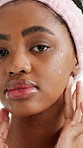 Skincare, acne patch and face of black woman in studio for self care, beauty treatment and glow. Dermatology, cosmetics and breakout with female person white background for facial and grooming