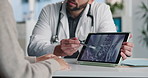 Tablet screen, xray and doctor with patient in hospital for treatment plan, healthcare or explaining. Digital technology, consultation and medical worker with person for radiology scan in clinic.