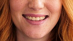 Woman, mouth and smile with closeup for dentistry, wellness and natural glow with freckles. Person, lips and happy with confidence, teeth and pride with oral hygiene, self care and dental health