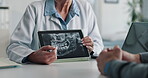X ray, tablet and doctor with patient consultation, medical advice and jaw exam in hospital. Healthcare, screen and professional woman with client discussion of mouth or facial scan in office