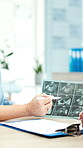 Xray, discussion and hands of doctor in hospital with medical diagnosis or treatment planning. Scan, conversation and healthcare worker in consultation for radiology results in clinic for checkup.
