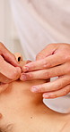 Relax, hands and woman with facial acupuncture for skin elasticity, fine lines or holistic therapy. Professional, girl and needles at spa for cosmetic treatment, alternative medicine and rejuvenation