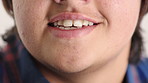 Teenager, dental care and smile with healthy veneers, teeth and clean mouth for fresh breath or wellness. Tooth whitening, healthcare and person with oral hygiene results, happy or treatment for gums