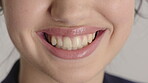 Woman, oral hygiene and smile for teeth wellness, veneers and clean mouth for fresh breath or health. Tooth whitening, healthcare and person with dental care results, happy and treatment for gums