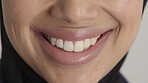 Dental, mouth and Muslim woman with smile, tooth wellness and gum cleaning in orthodontics. Healthcare, happy and Arab person with oral hygiene, enamel protection and teeth whitening in dentistry.