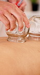 People, hands and cupping therapy with massage bed for spa, body treatment or vacation in salon. Woman, relax and glass for holistic healing, zen or beauty session for inflammation or circulation