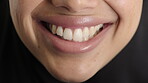 Woman, dental care and smile with healthy teeth, veneers and clean mouth for fresh breath or closeup. Tooth whitening, healthcare and person with oral hygiene results, happy and treatment for gums