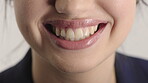 Woman, oral hygiene and smile for teeth health, veneers and clean mouth for fresh breath or wellness. Tooth whitening, healthcare and person with dental care results, happy and treatment for gums